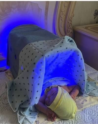 Фотолампа от желтушки