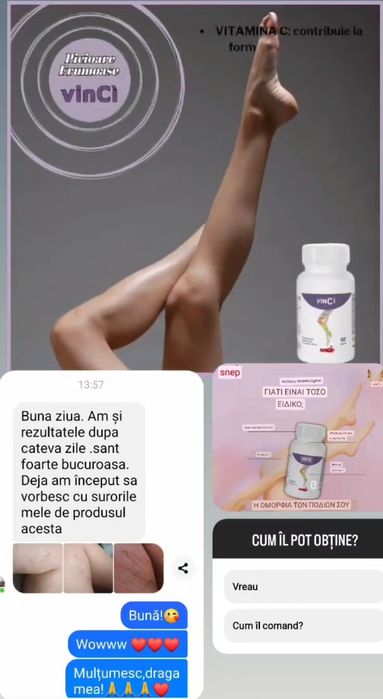 Cum am scăpat eu de durerile de picioare,picioare grele și umflate!