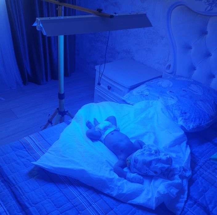 Фототерапия для новорожденных