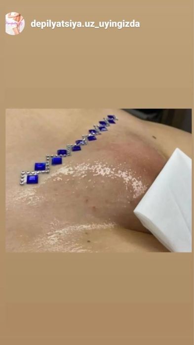 Depilyatsa ga SHOGIRT OLAMAN