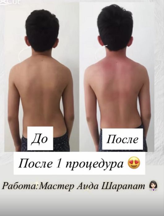 Выездной оздоровительный массаж