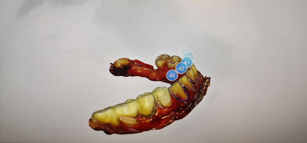 Scanner intraoral Dentsplay Sirona   Cerec