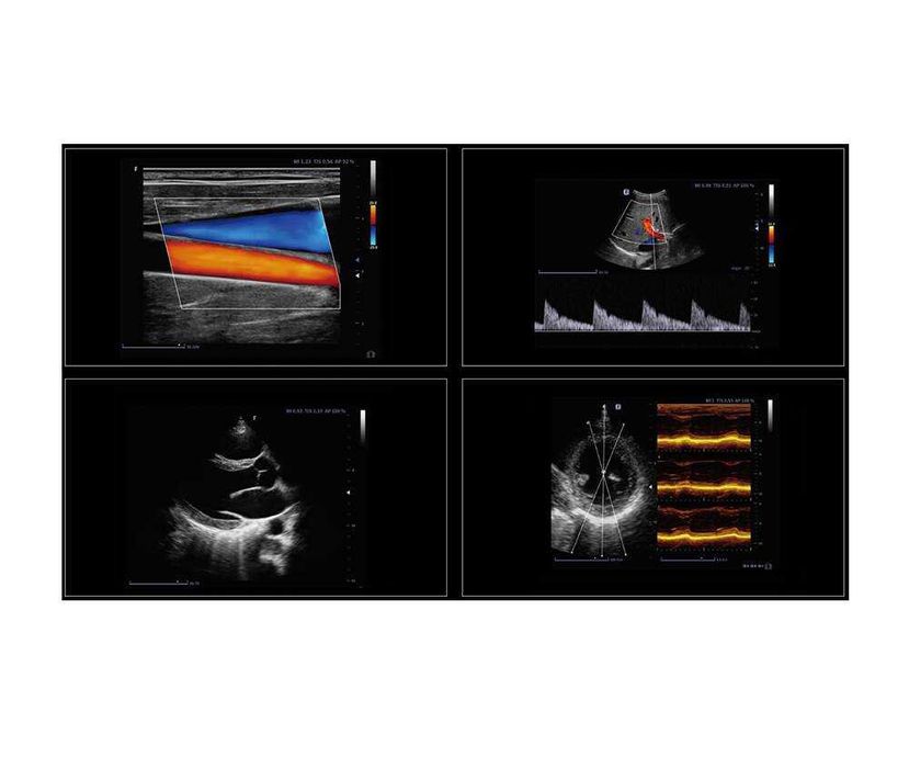 Finus 70 – портативный диагностический ультразвуковой аппарат