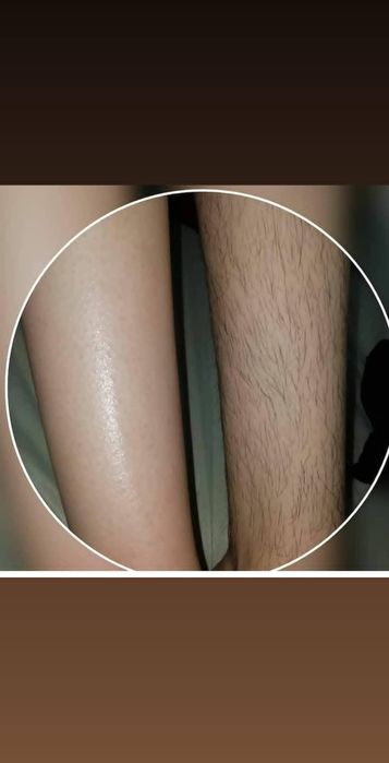 Депиляция еднди уйингизга бориб хизматингизда