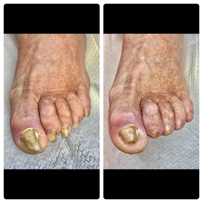 Pedichiură complexă