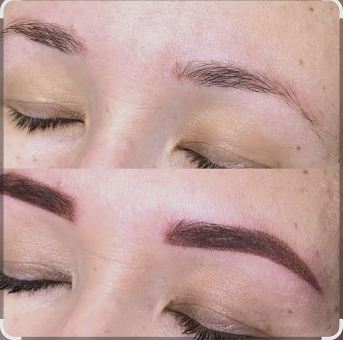 Акция Удаление татуаж брови лазером 200тысяч