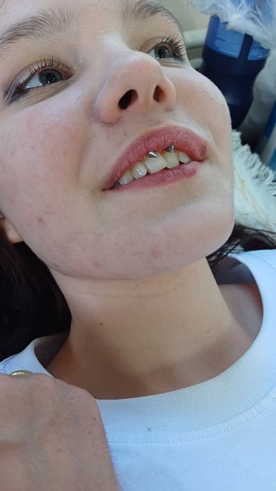 Прокол ушей , пирсинг качественно