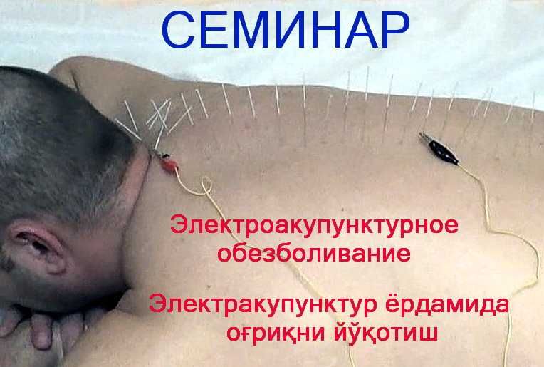 Семинар по обезболиванию болей в спине / Белдаги оғриқларни йўқотиш
