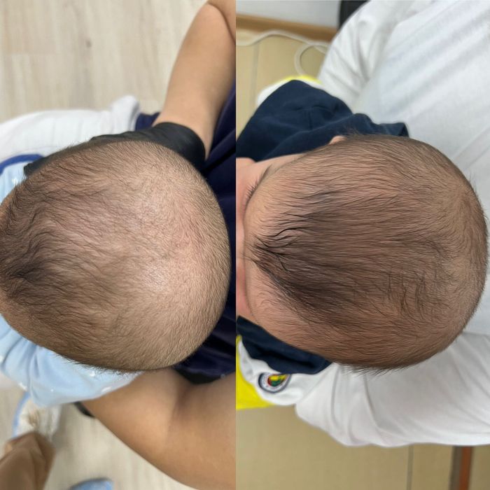 Ортопедическая каска (шлем)