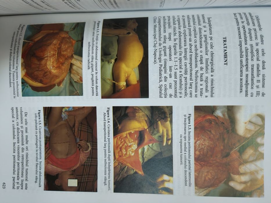 Tratat de Chirurgie Uro Oncologie vol. IX Ed. 2-a. Ioan Coman,