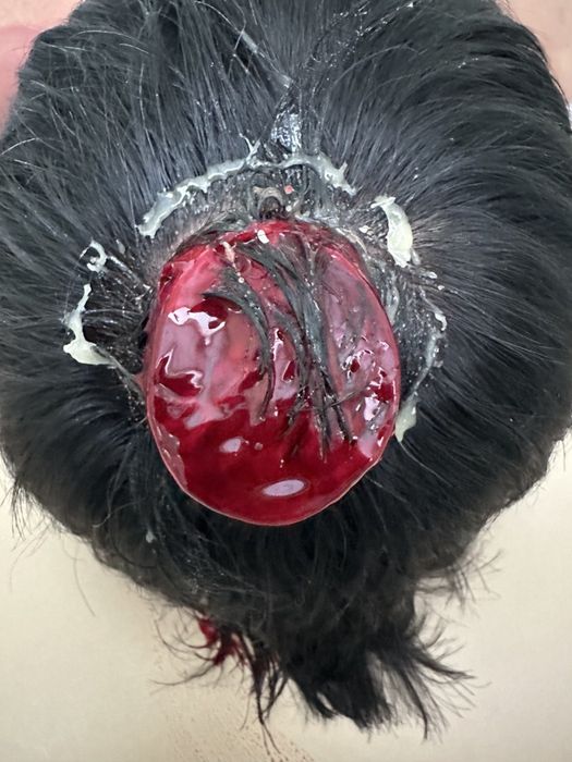 Хиджама в районе 45 квартала