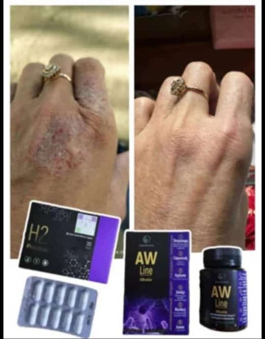 Продам Н2Магний водород