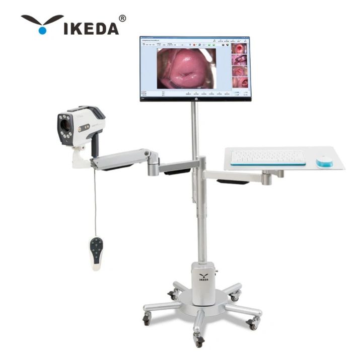 Кольпоскоп IKEDA YKD3003 в наличии
