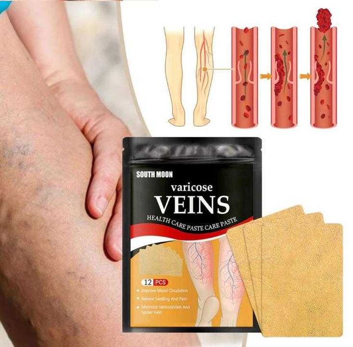 12 броя Пластир за Разширени Вени Лепенка за Лечение на Разширени Вени