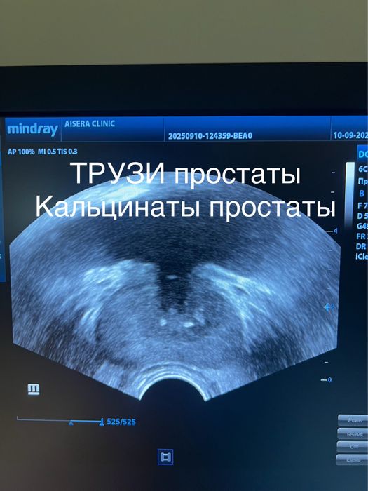 Уролог-андролог|цены доступные|лечение|операции