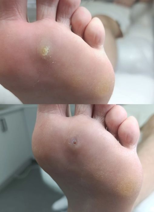 Подолог на выезд