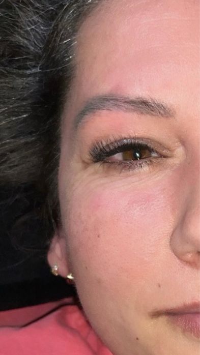 Extensii gene Timisoara