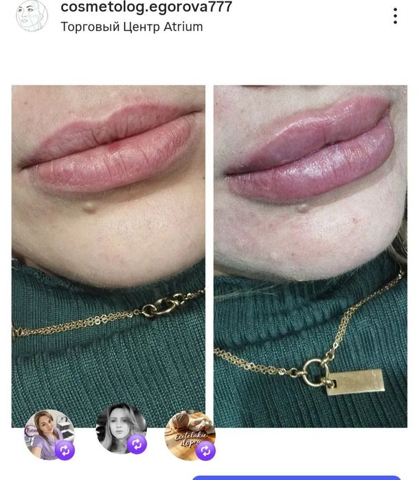 Прокалывание ушей