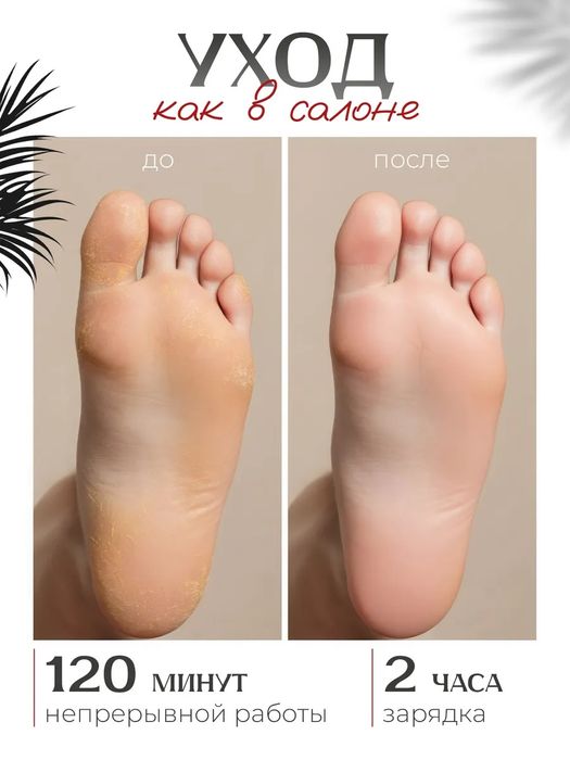 Электрическая пилка для пяток мощная аппарат для педикюра