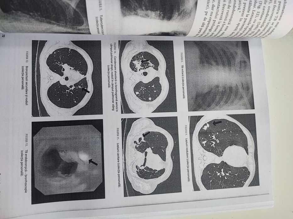 Tratat de Medicina interna  camelia diaconu