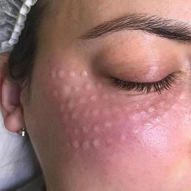 Косметолог шошиламиз кизлажонла декабр ойга  котта скидка