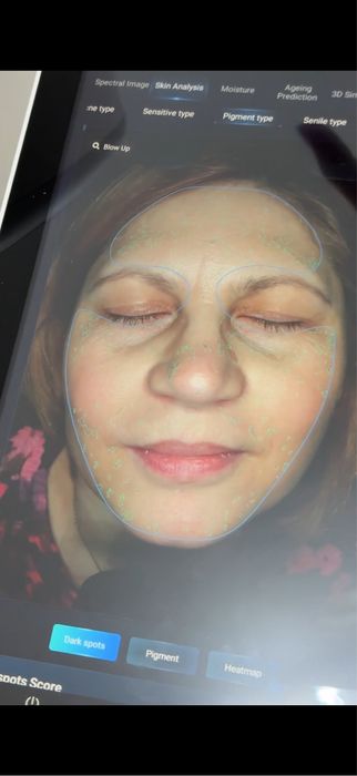 Analizator facial profesional cu AI si recomadarea rutinei