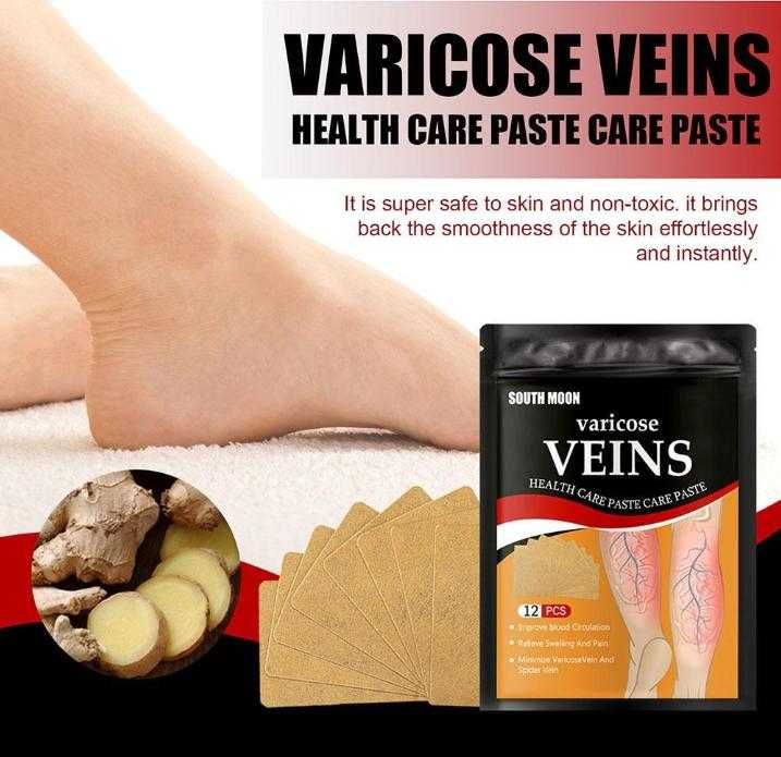 12 Пластири за Разширени Вени Лепенка Лечение Разширени Вени Варикоза