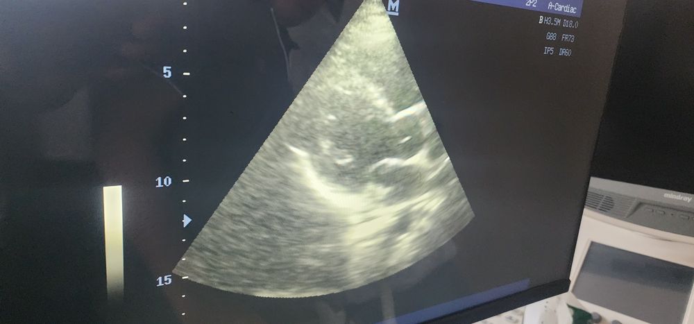 Миндрай дс7 узи аппарат