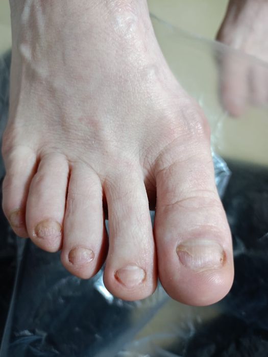 Медицинский педикюр от 10000