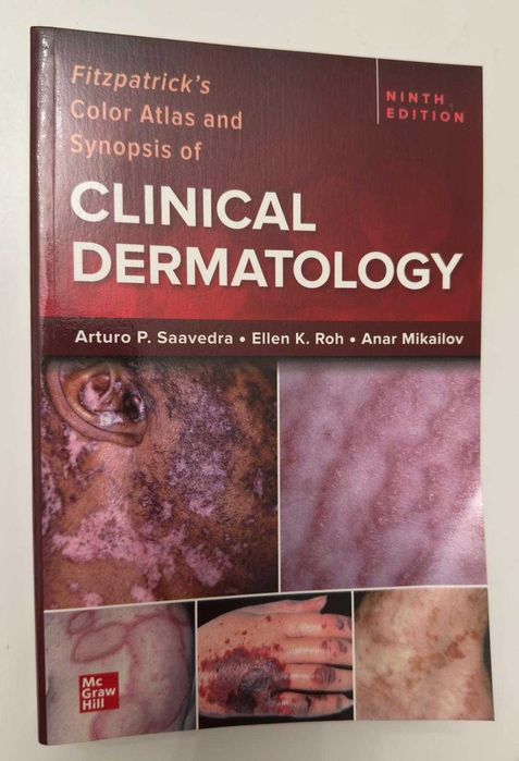 Fitzpatrick's Color Atlas and Synopsis of Clinical Dermatology NOU !
