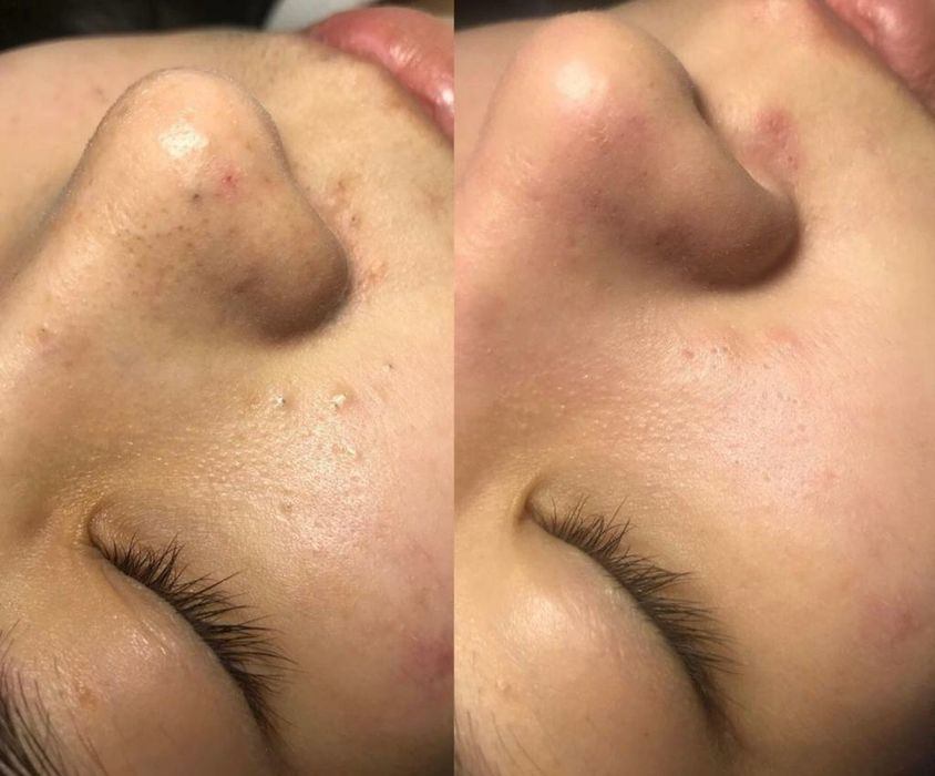 Услуги косметолога