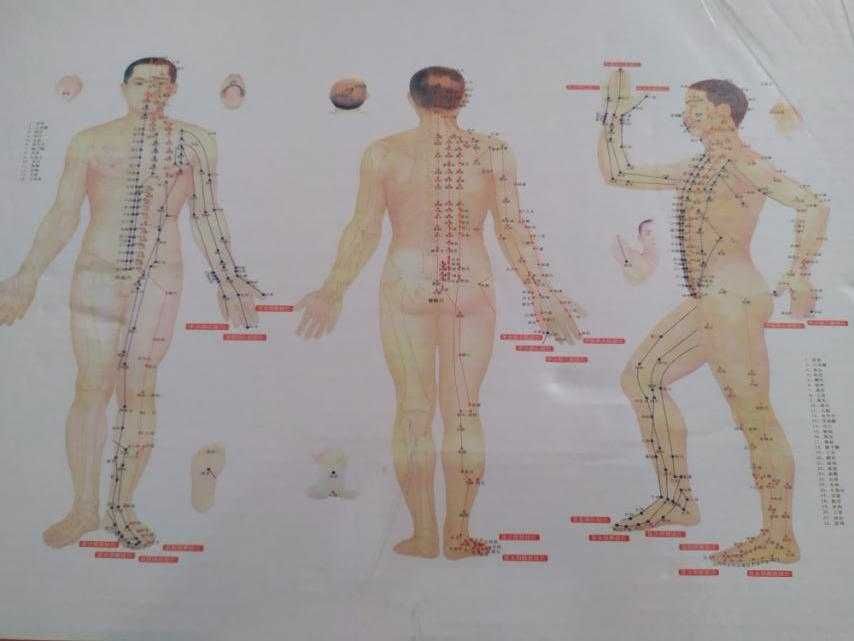 Професионален комплект вендузи, 32 броя + магнити и етерично масло