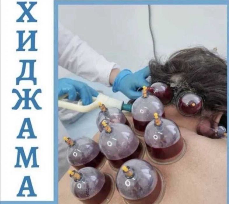 Хиджама | Пиявки | Шертпе ВЫЕЗД