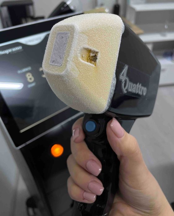 Лазер за епилация