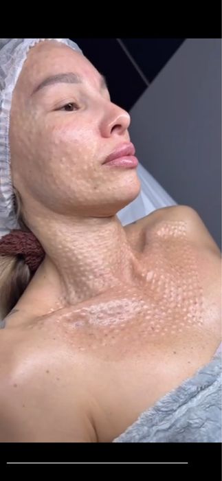 Лазер | Ботокс | Пилинги | Удаление татуажа | Косметолог