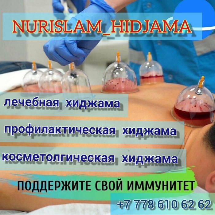 Алматы Хиджаманың барлық түрі