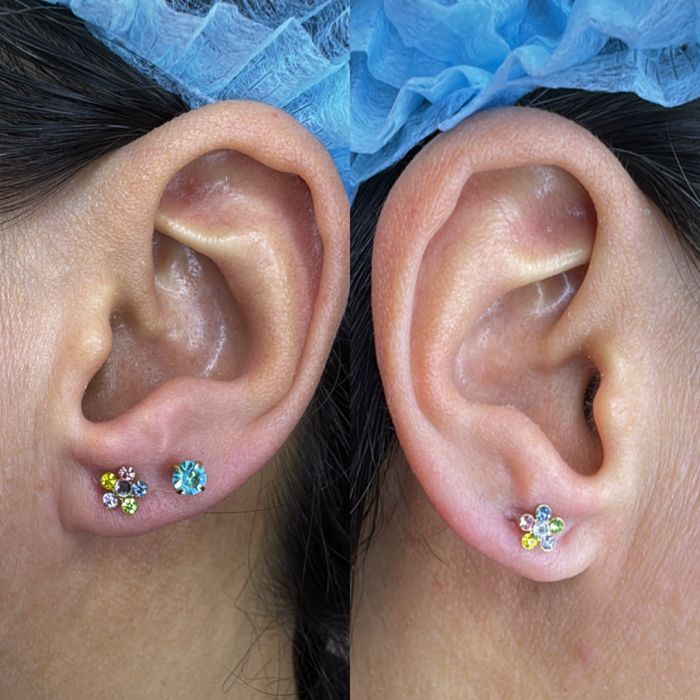 Прокол ушей стерильно и безопасно- от 13000