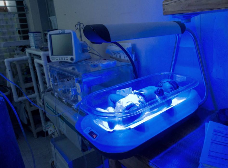 Фотолампа, лечение желтушки у новорожденных на дому