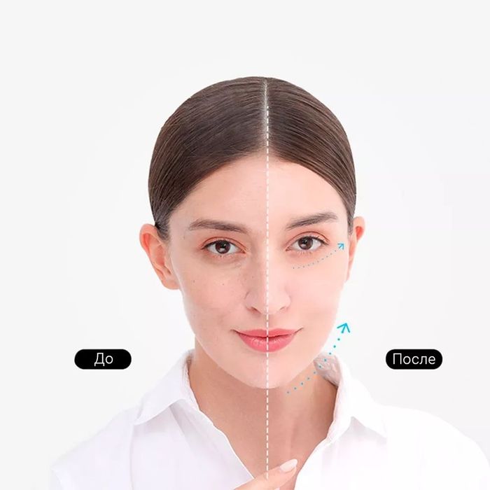 Аппарат для ультразвуковой чистки кожи Xiaomi InFace Ultrasonic Ion Sk