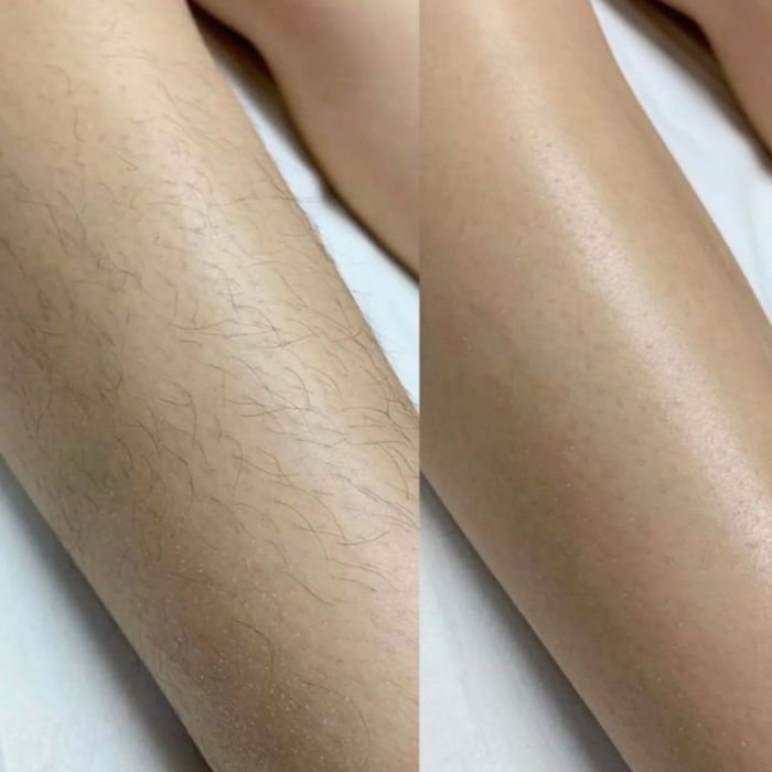 Шугаринг для девушек