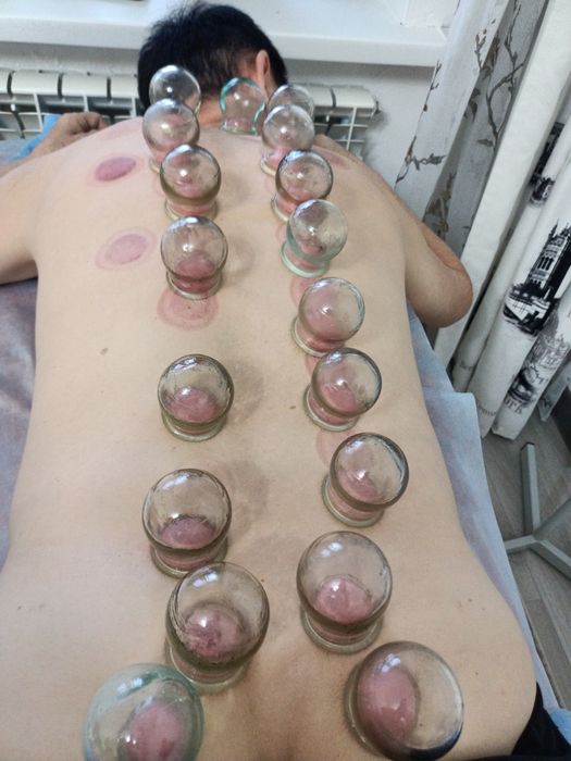 Народный метод лечения.