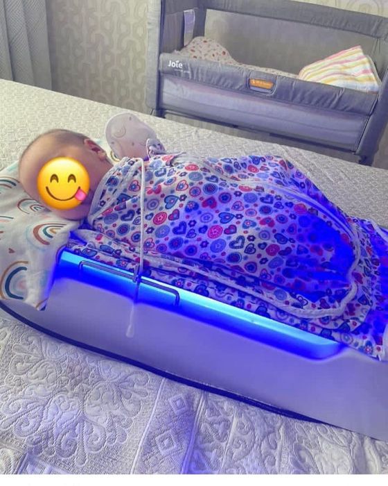 Фотолапма От Желтушки Алматы