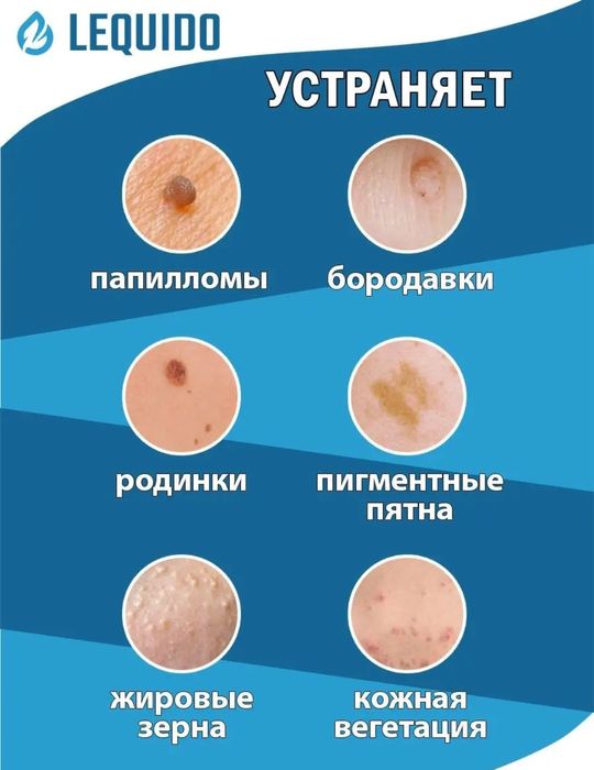 Коагулятор от бородавок и папиллом