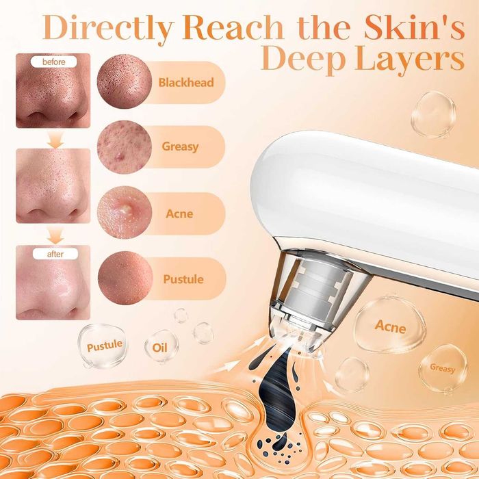 Вакуумен уред за почистване на пори,премахване на черни точки, подарък