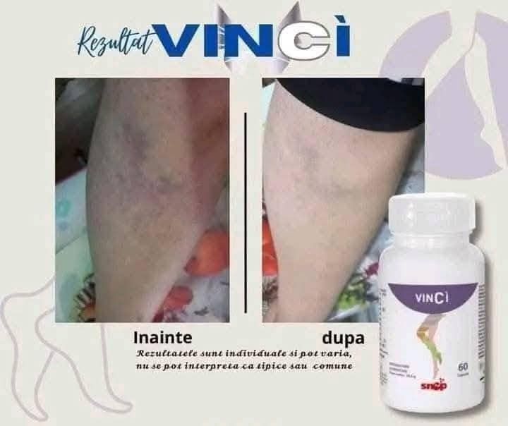 Vincì Snep – Supliment Circulație & Picioare Ușoare