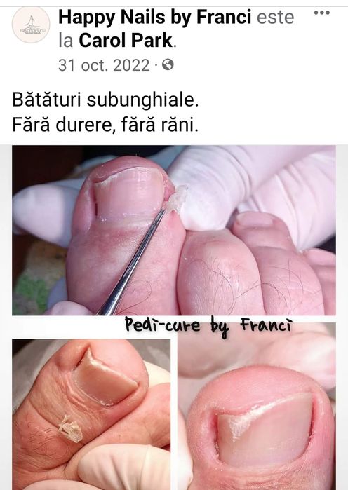 Pedichiura medicala și manichiura(acreditat)