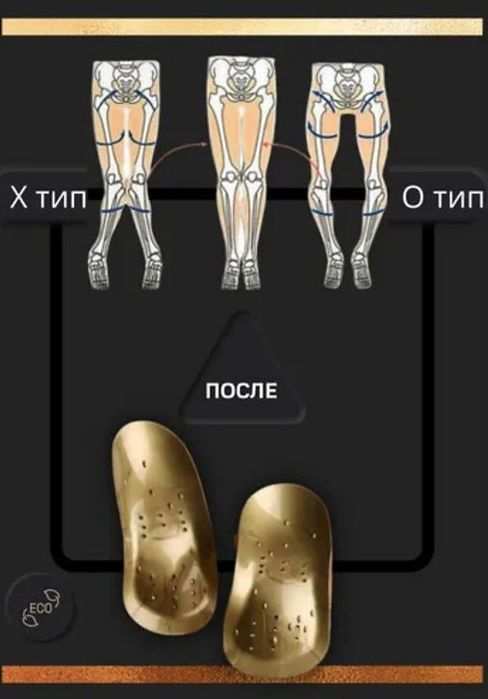 Коррекционные стельки WHIEDA