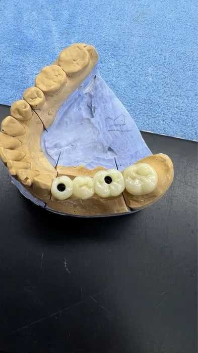 CAD/CAM – Цифровая зуботехническая стоматология