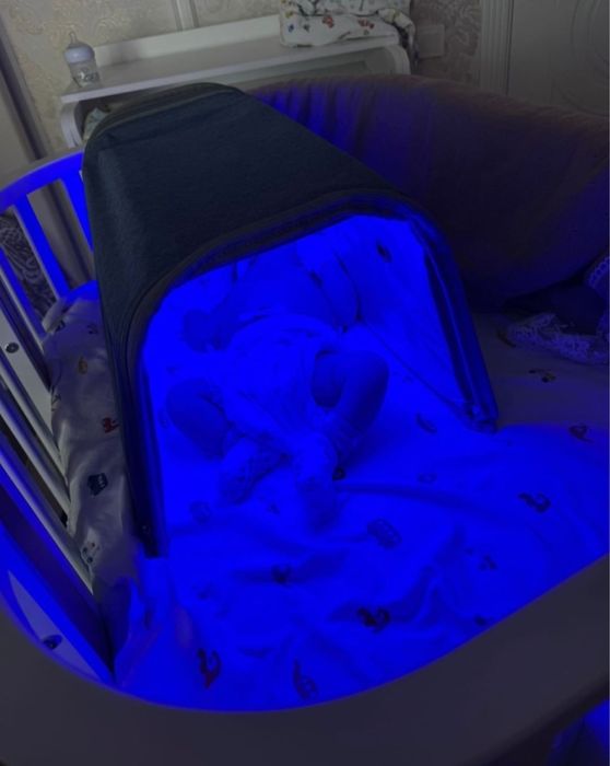 Фотолампа от желтушки