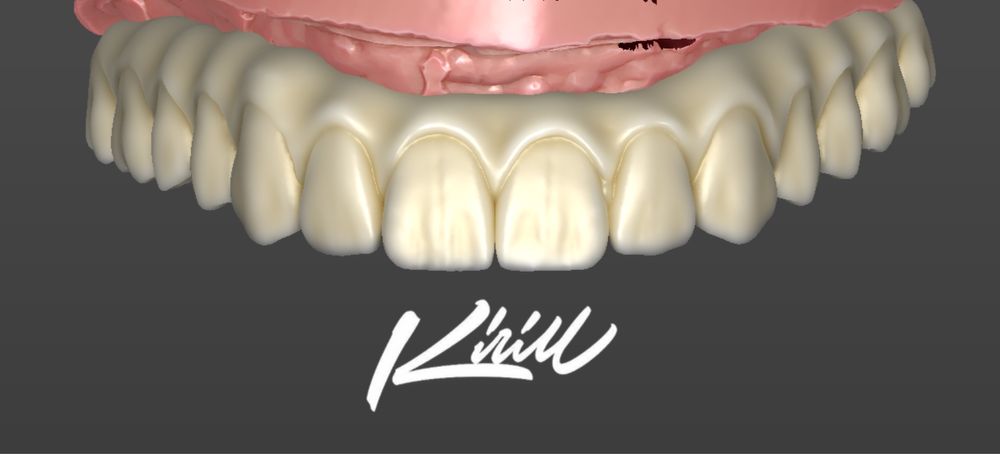 Моделирование зубов (exocad/blender)